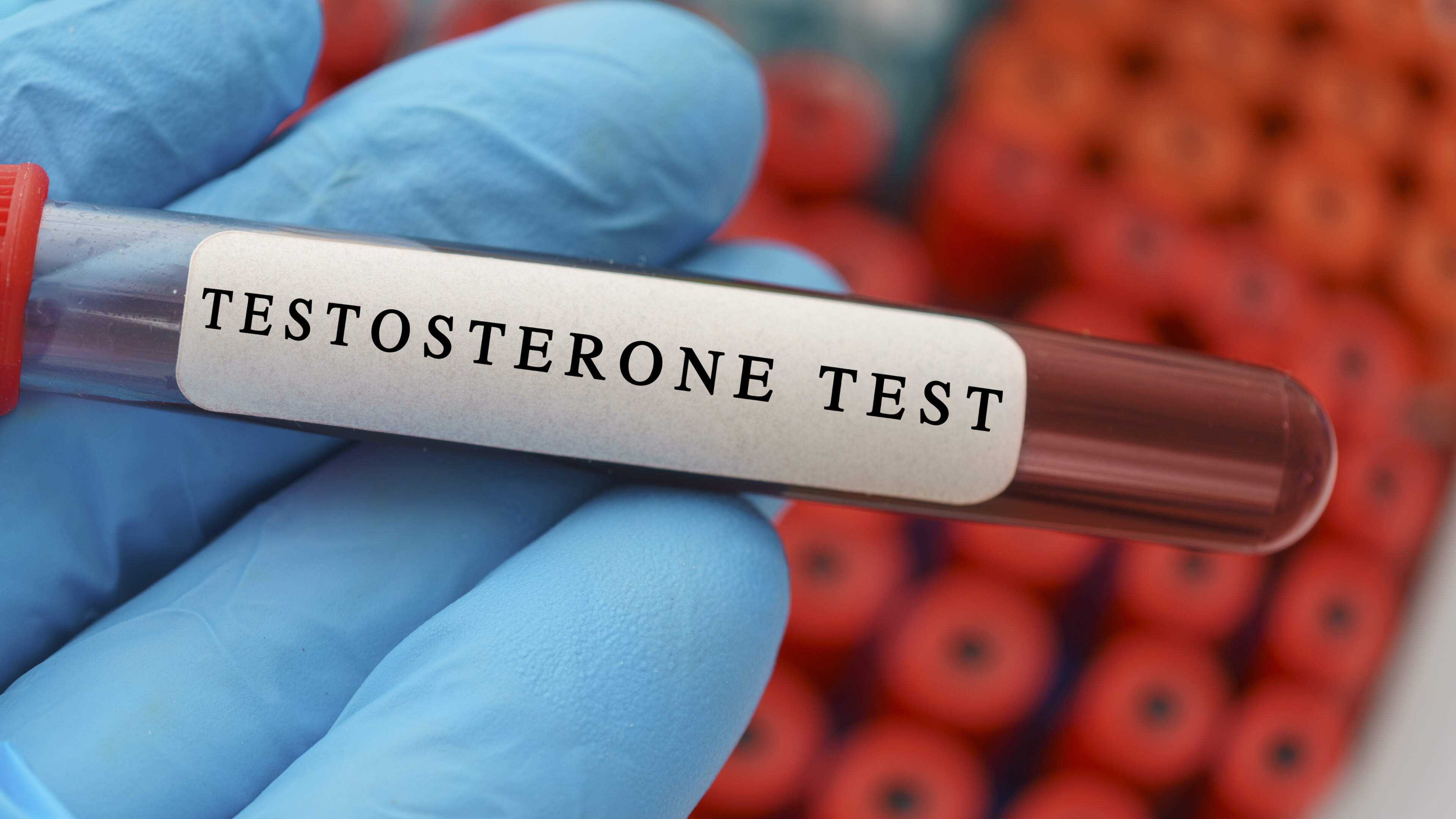 Men's Testosterone Levels Decline Over 50 Years