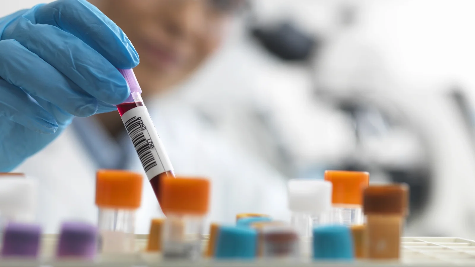 Ireland unlikely to end HIV transmission by 2030