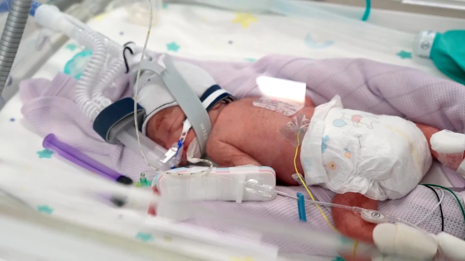 Australian woman welcomes rare identical quadruplets