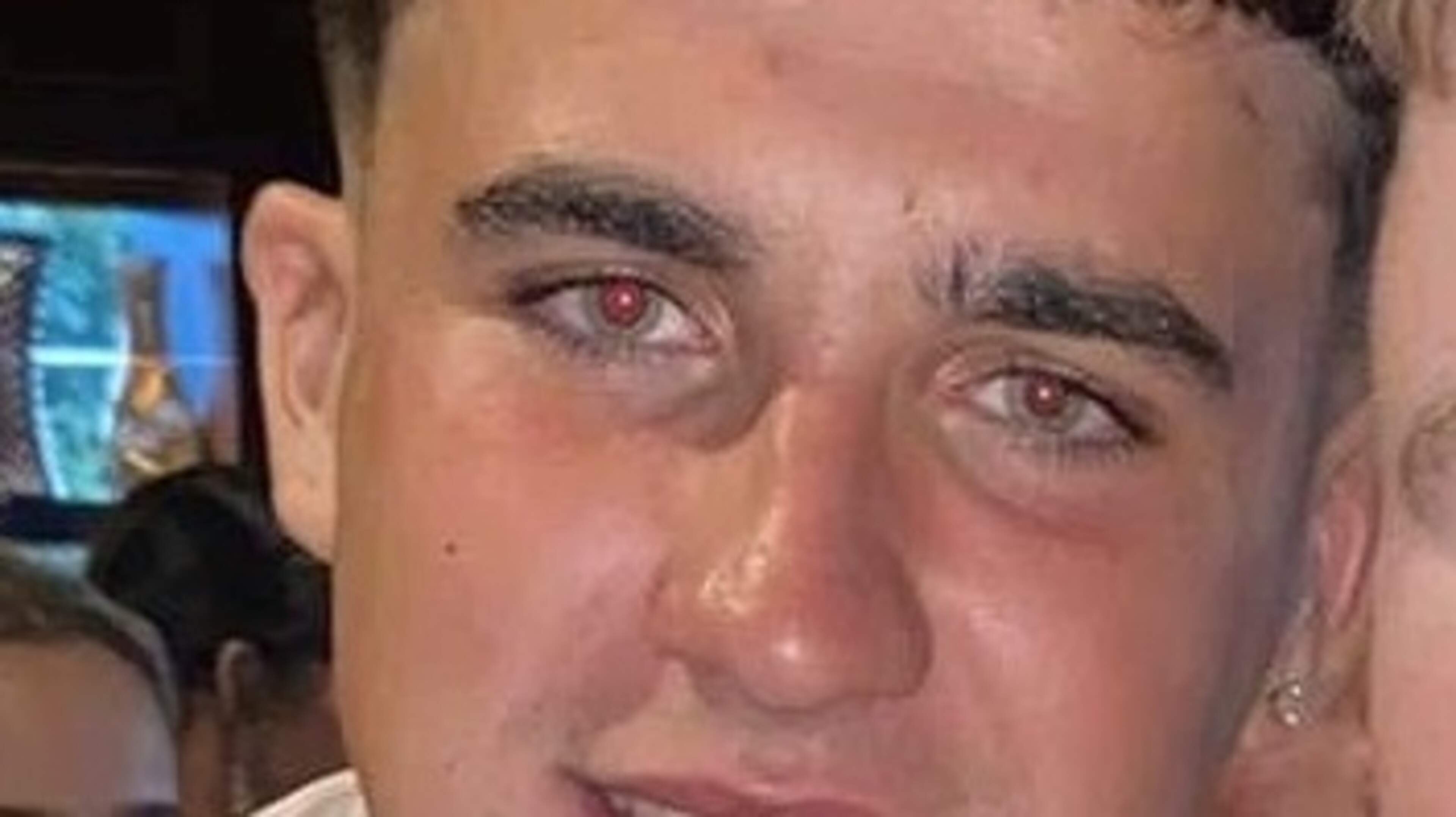 Teen Dies in Tipperary Car Crash