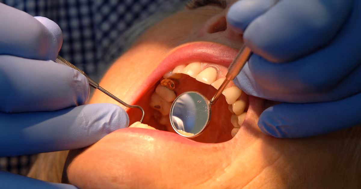 Northern Ireland Dentists Average Earnings Rise to £185,000