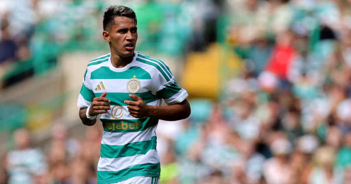 Celtic vs Dundee: Season Opener Details