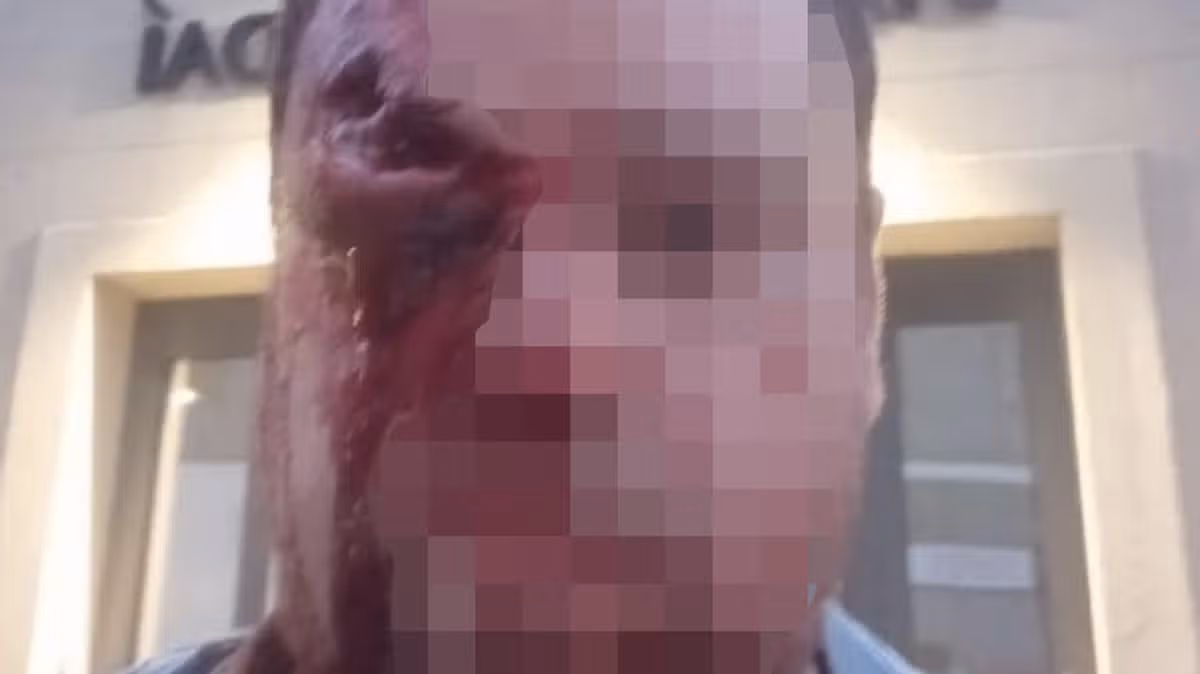 Man Injured in Violent Tuam Street Brawl