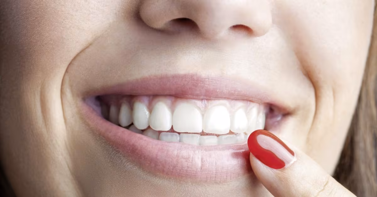 Teeth Whitening and Lip Surgery Tax Deductibility