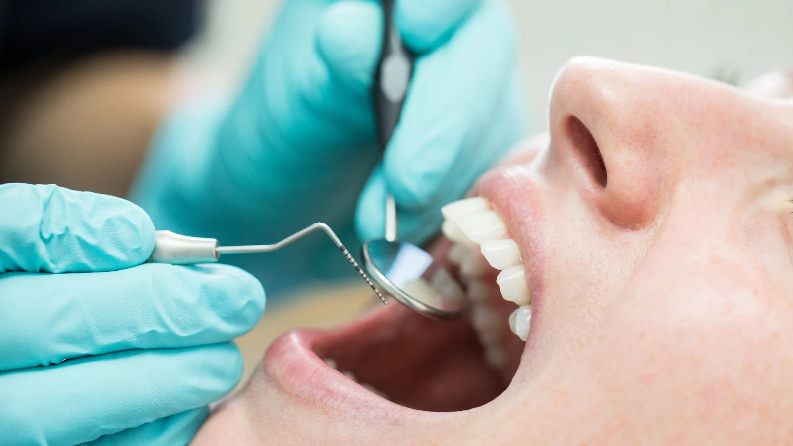 35% Drop in Medical Card Scheme Dentists