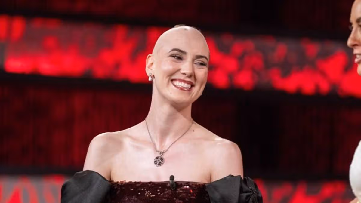 Westmeath Rose Opens Up About Alopecia