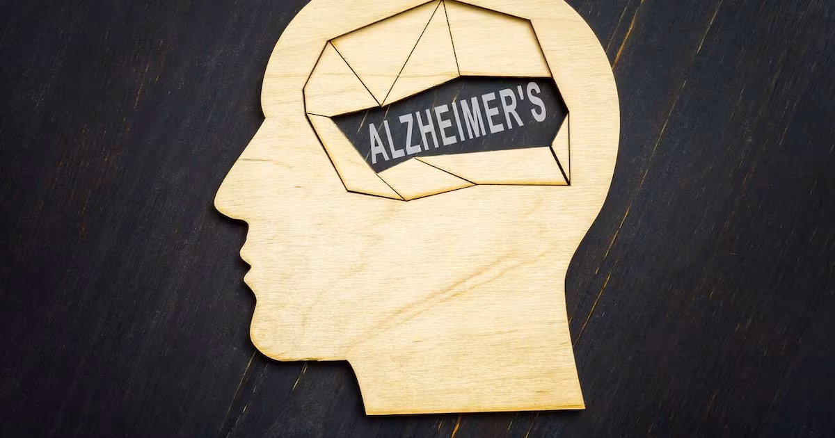 Understanding Alzheimer's Disease and Its Impact