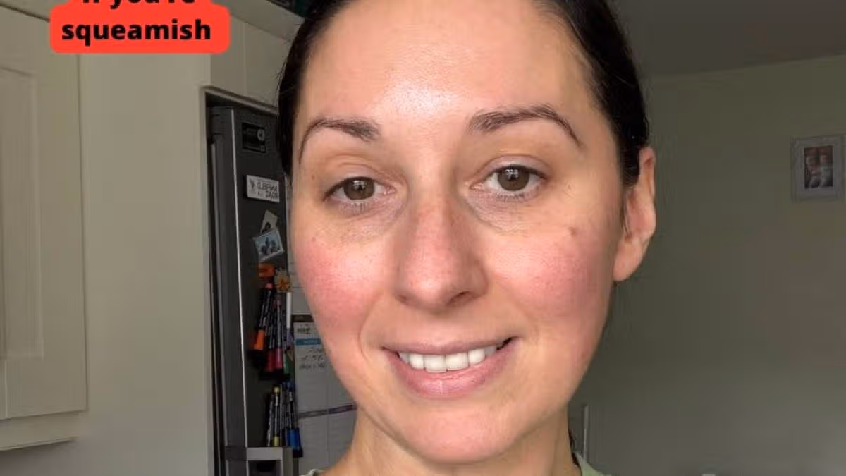 Traitors winner Rachel Duffy undergoes surgery