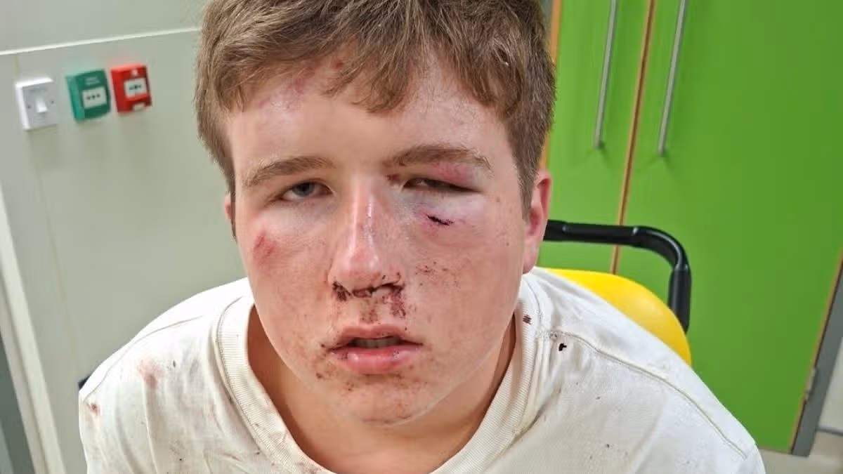Teen assaulted in unprovoked gang attack