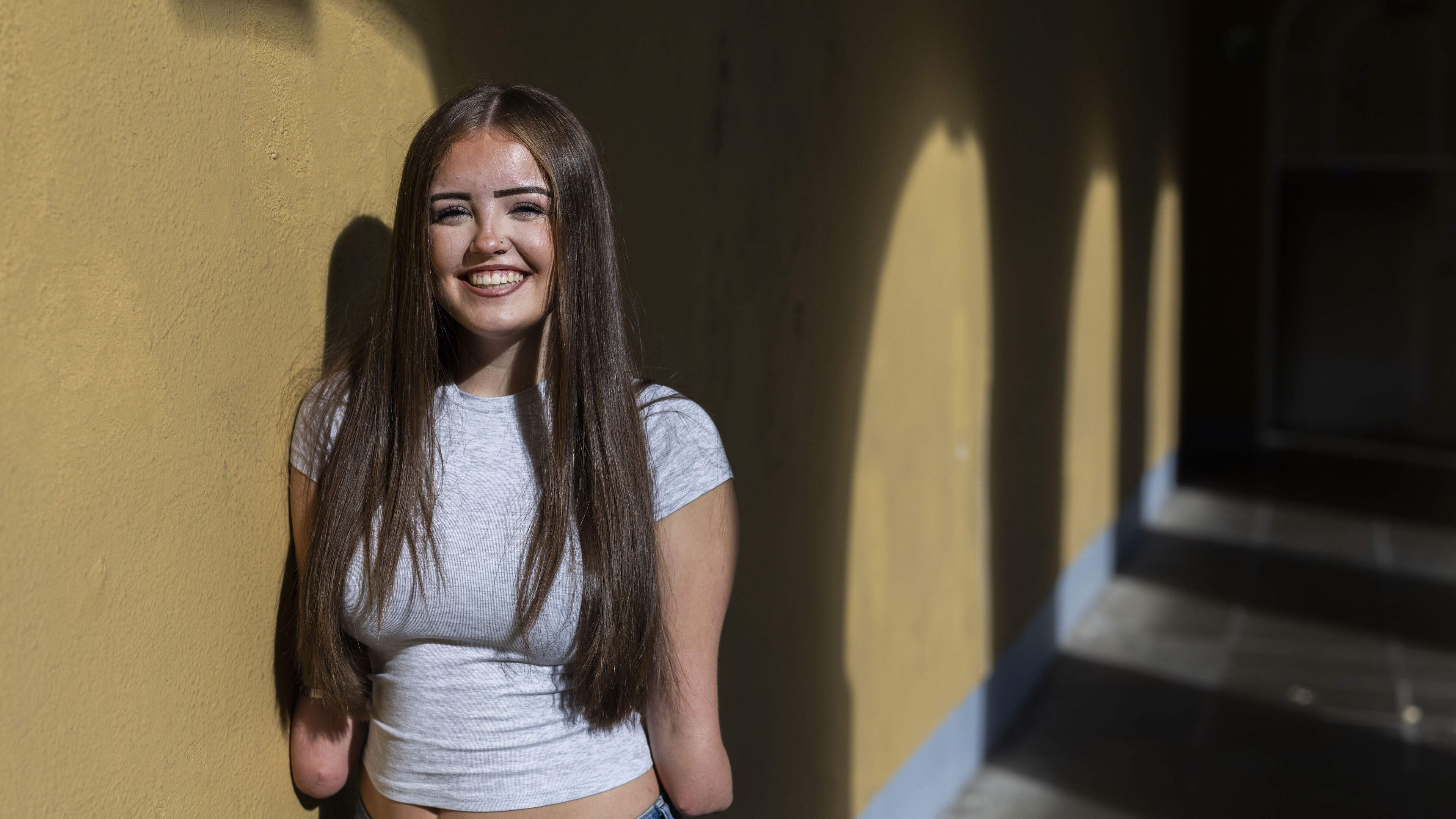 Dublin teen's sepsis ordeal leads to amputations