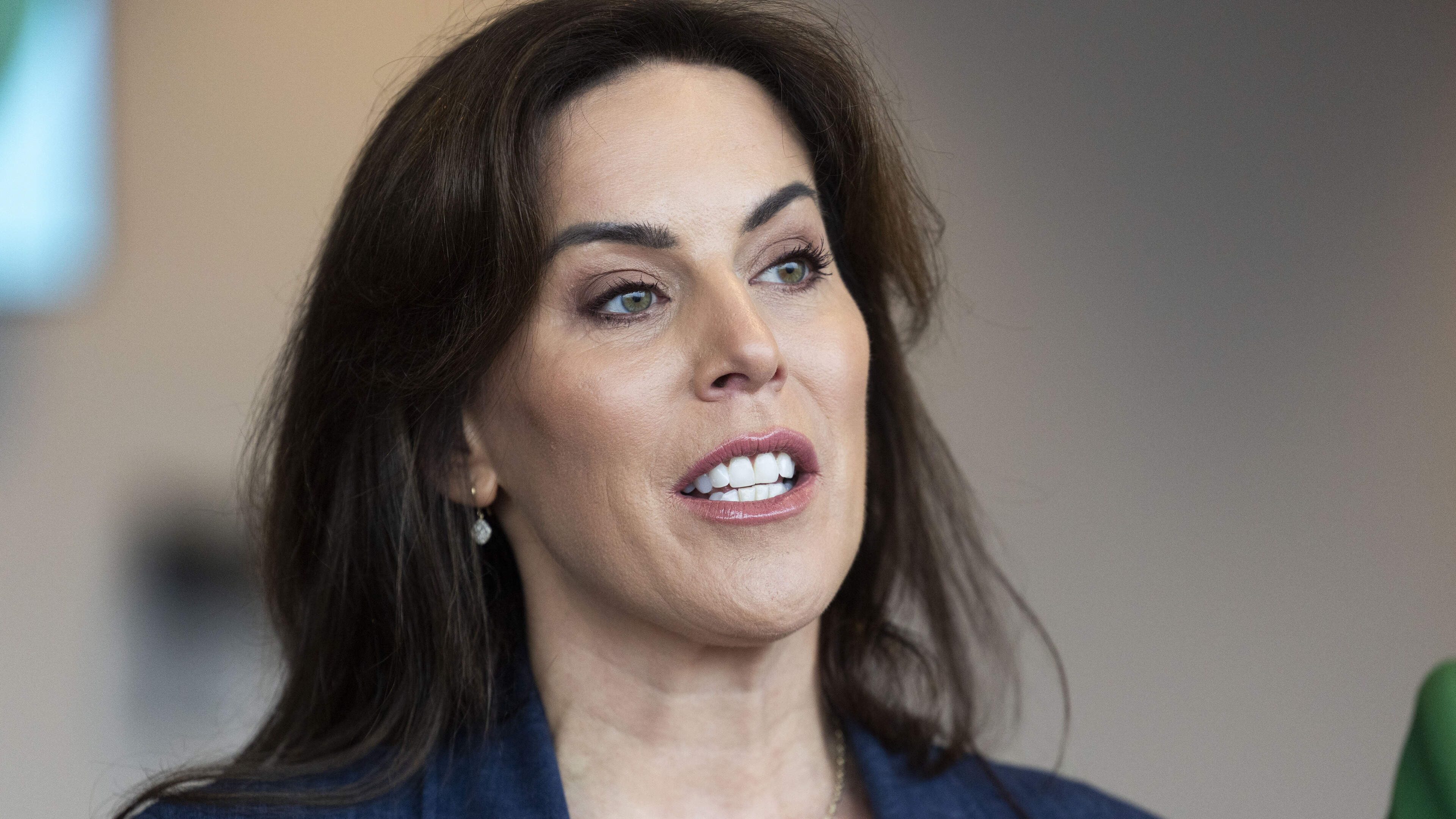 HSE Clarifies Patient Movement During Minister's Visit