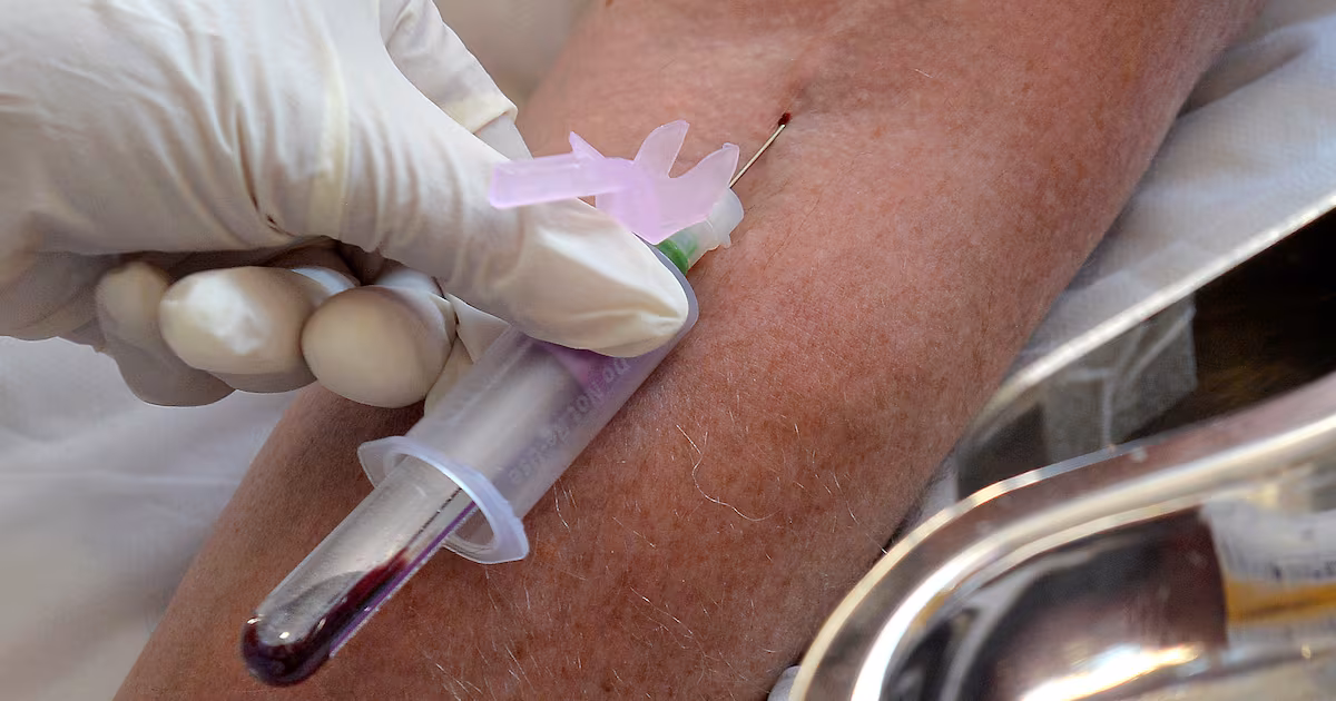 New Sepsis Test Identifies Infection Faster