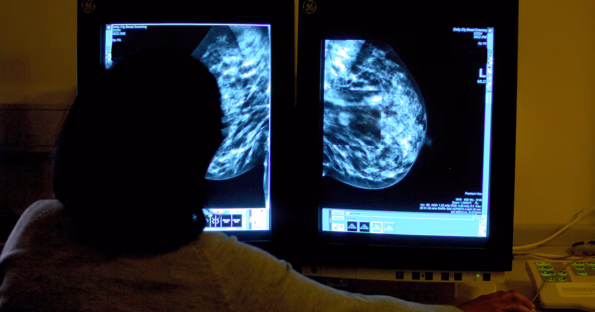 Breast cancer risk linked to alcohol in women