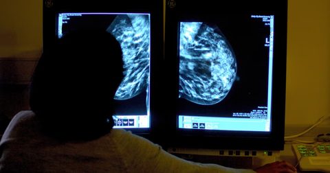 Breast cancer risk linked to alcohol in women